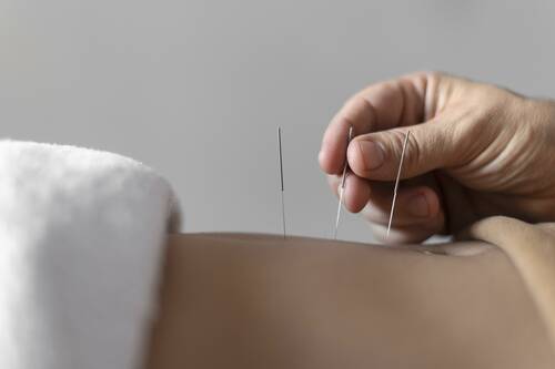 Close up hand holding acupuncture needle